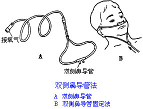 ◆肺病患者如何家庭氧療？